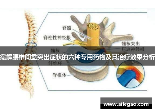 缓解腰椎间盘突出症状的六种专用药物及其治疗效果分析